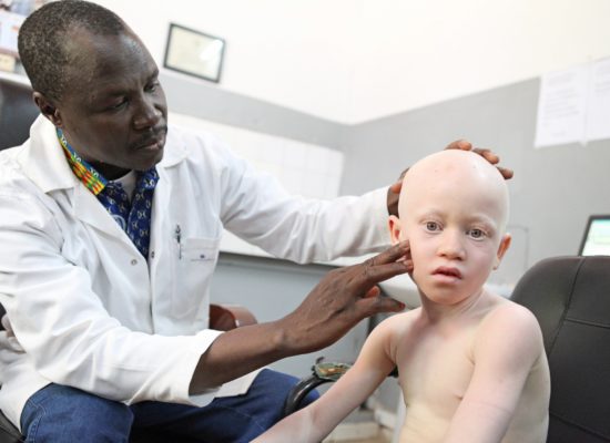 Consultation d'un enfant atteint d'albinisme au Centre national de lutte contre la maladie de Bamako, Mali